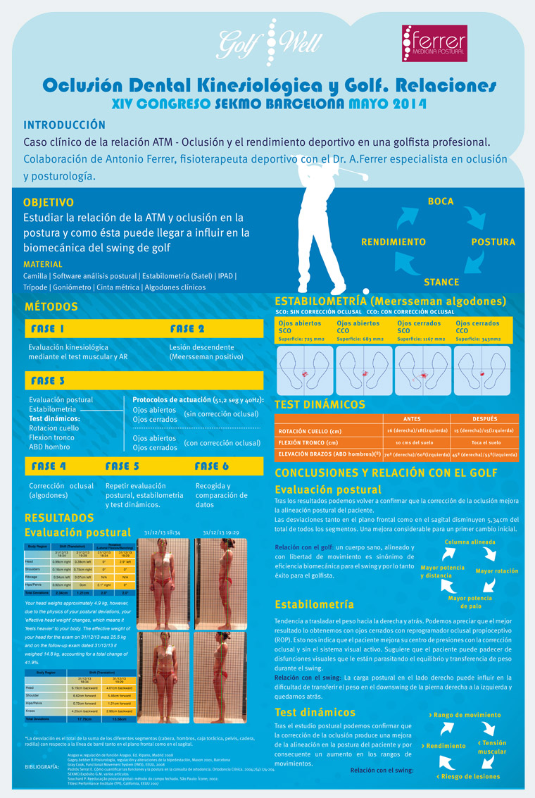 Póster sobre la Oclusión Dental Kinesiológica y el Golf